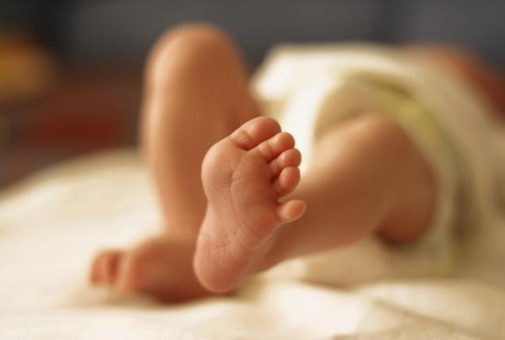 Kisah penyelamatan bayi perempuan yang lahir berkaki tiga
