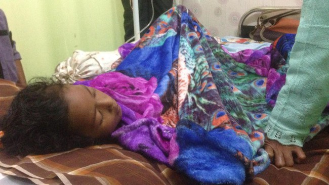 Derita Fazira, bocah asal Aceh yang terluka bakar serius